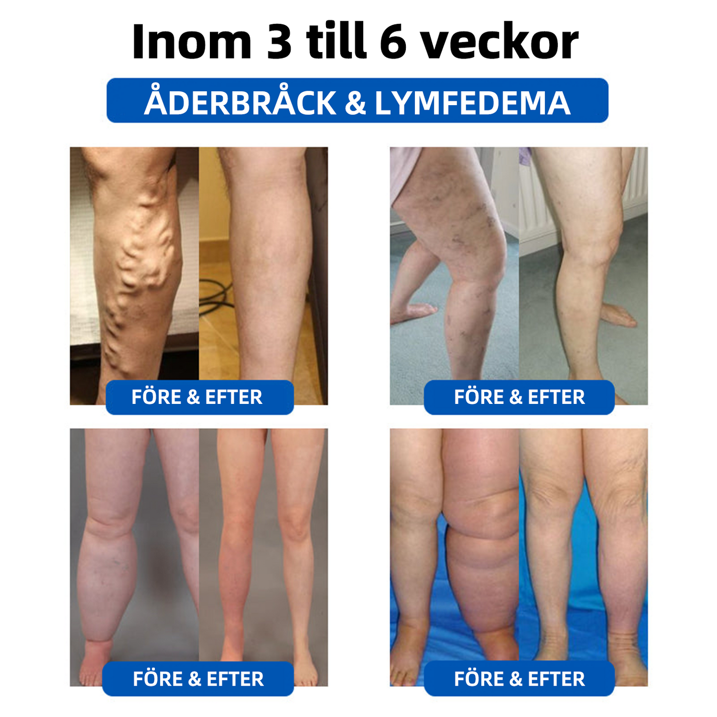 𝐇𝐞𝐥𝐚 𝐤𝐫𝐨𝐩𝐩𝐞𝐧𝐬 𝐯ä𝐥𝐛𝐞𝐟𝐢𝐧𝐧𝐚𝐧𝐝𝐞 𝐛ö𝐫𝐣𝐚𝐫 𝐡ä𝐫 -👩⚕️𝐂𝐙𝐓𝐥𝐂𝐋𝐄® 𝐇ö𝐠𝐟𝐫𝐞𝐤𝐯𝐞𝐧𝐭 𝐮𝐥𝐭𝐫𝐚𝐥𝐣𝐮𝐝 𝐌𝐮𝐥𝐭𝐢𝐟𝐮𝐧𝐤𝐭𝐢𝐨𝐧𝐞𝐥𝐥 𝐬𝐦𝐚𝐫𝐭𝐤𝐥𝐨𝐜𝐤𝐚🔥🔥🔥